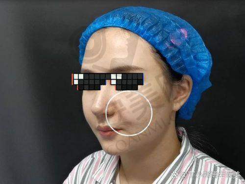总结