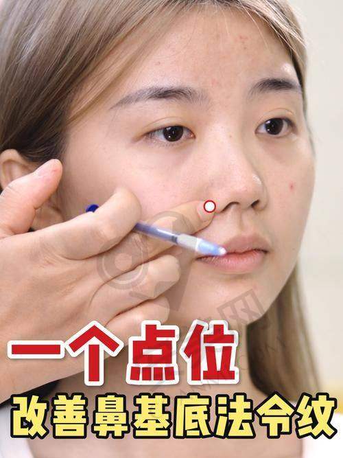 玻尿酸去法令纹的价格是如何确定的？