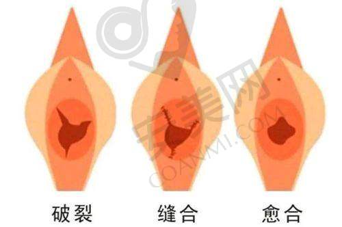 总结