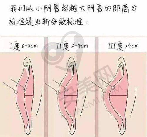 北京嘉禾私密整形价格包含哪些费用？
