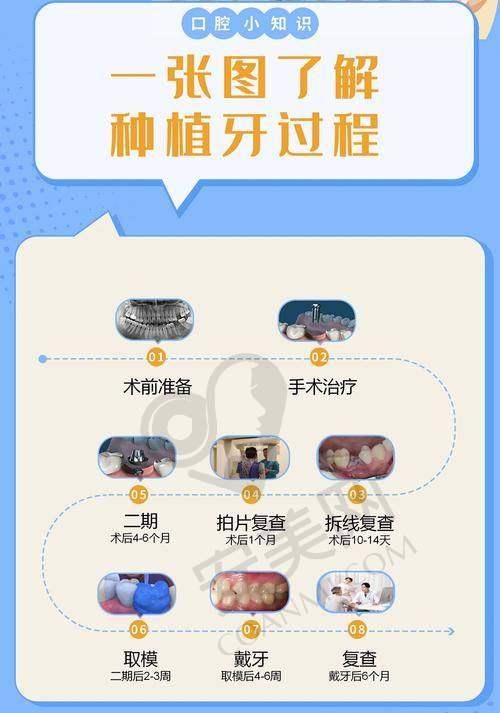 如何前往沈阳德立联合口腔进行种植牙询问？