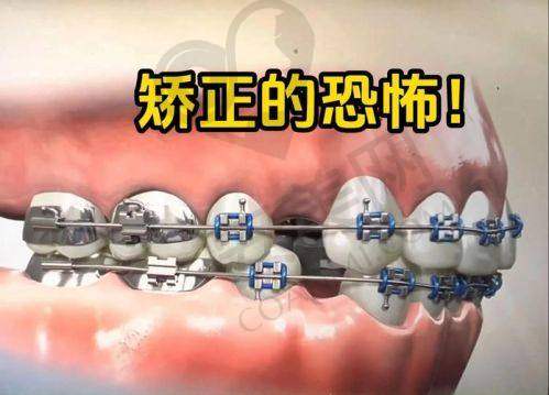 济南好牙口腔马跃医生怎么样？