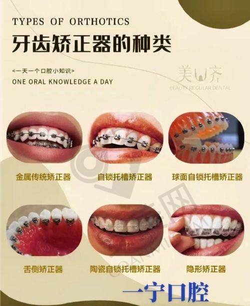 包头幸福口腔的隐形矫正过程是怎样的？