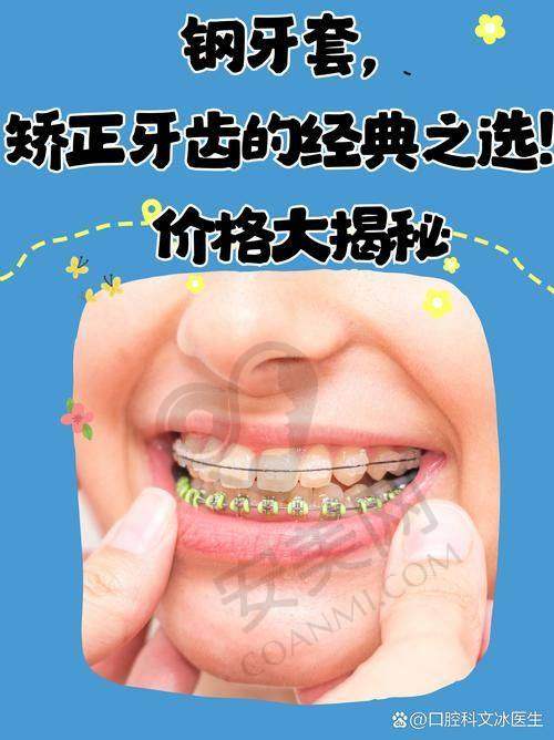 无锡维乐口腔金属托槽矫正价格分阶情况如何？