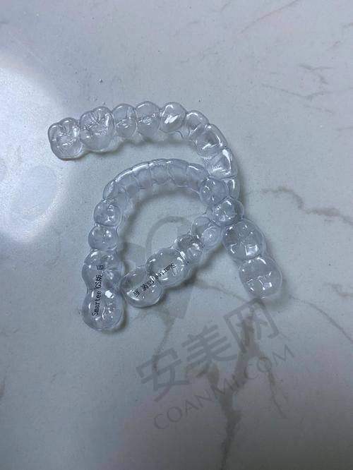 正雅隐形矫正是什么？