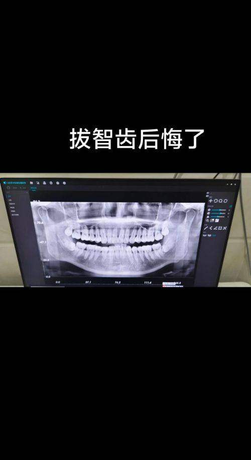 在曲靖舒尔口腔的就诊过程是怎样的？