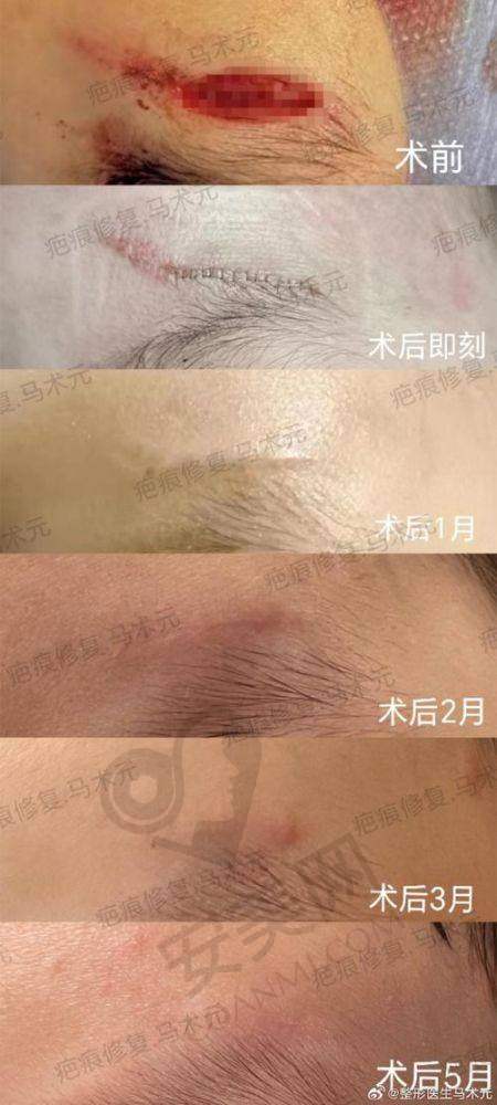 排名6：昆明艺星医疗美容医院