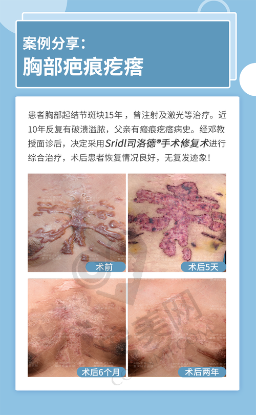 排名1：昆明昆大疤痕医院
