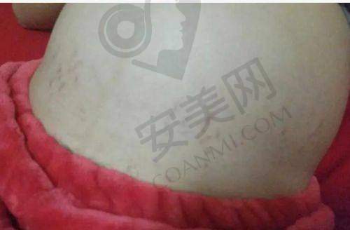 上海普陀宏康医院治疗胎记疤痕的优势