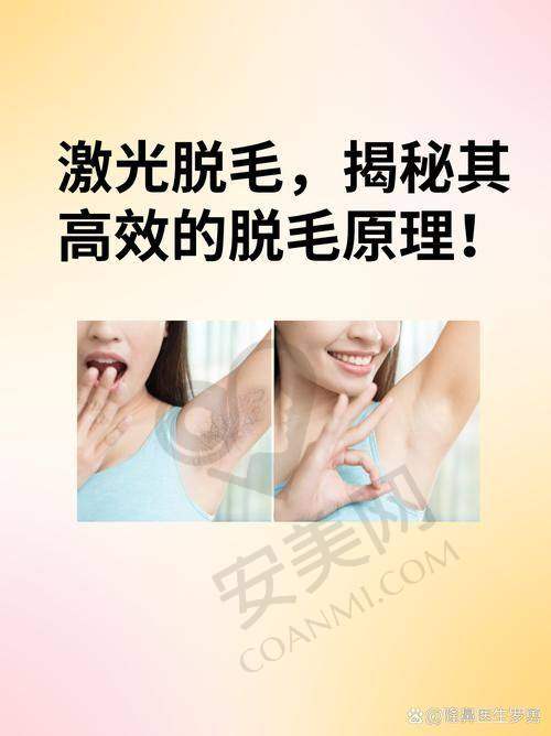西安艺星全身脱毛前要做哪些准备？