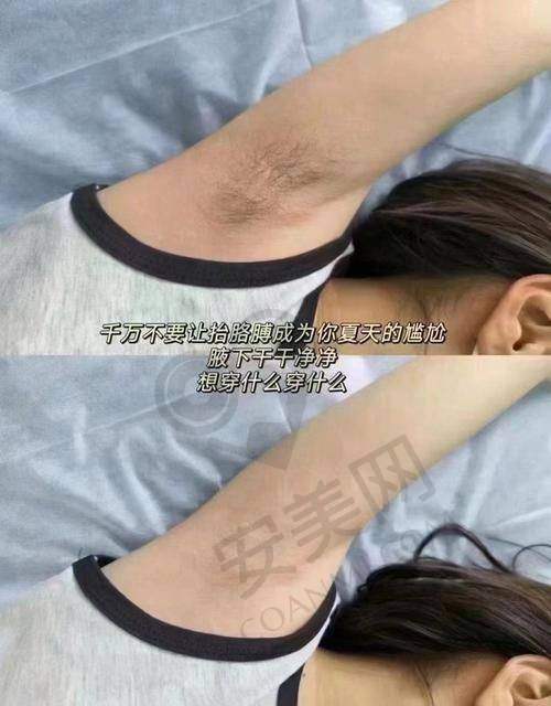 西安艺星全身脱毛靠谱吗？初印象了解