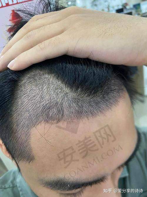 南京新生植发医院整体概况