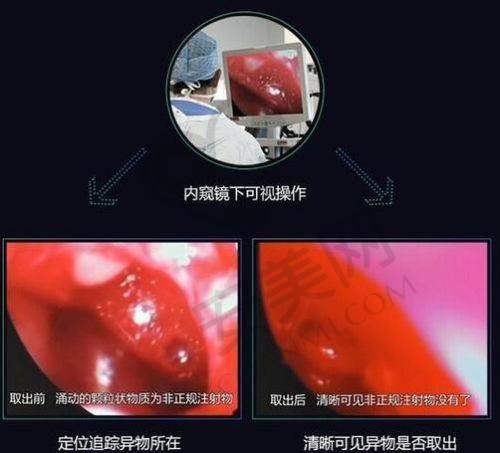 6、郭鑫医生预约挂号指南
