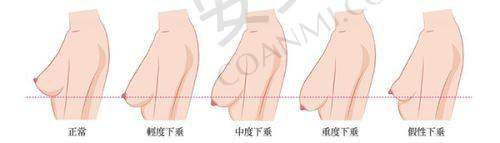 医生的预约流程复杂吗？