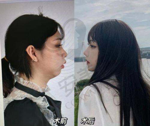 治疗色斑哪位医生更专精？
