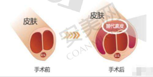 6、哈尔滨韩美单宝泉医生预约挂号指南