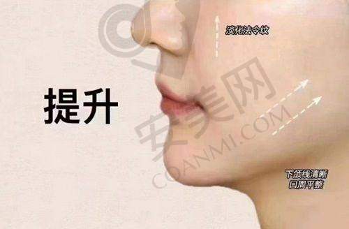 上海华美面部提升适合哪些人群？