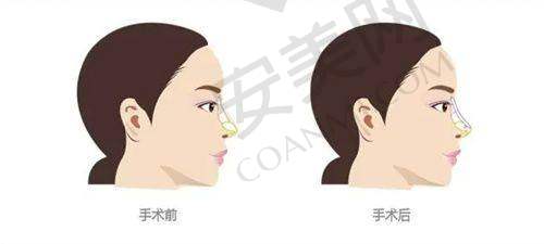 如何选择适合自己的医生？