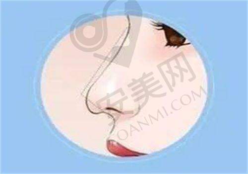 5、保定华美赵晓刚院长患者评价
