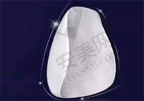 牙齿贴面美白的成效能维持多久？