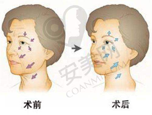 北京润美玉之光价目表在市场上处于什么水平？