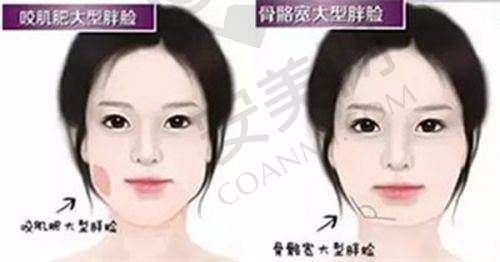 1、大连星妍李伟医生怎么样？
