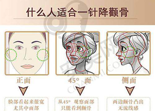 西安西美医院激光溶脂的治疗过程是怎样的？痛苦吗？