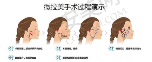 深圳艺星和美莱的医生团队谁更出色？