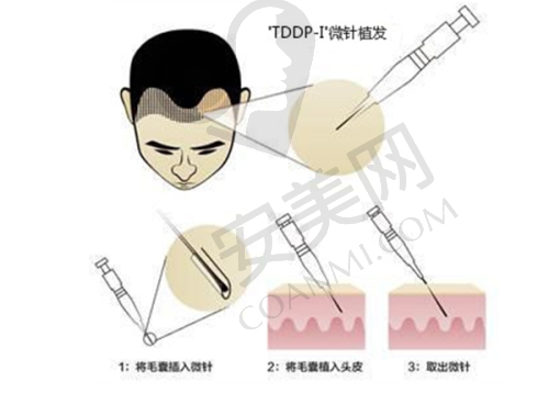 广州崇爱植发医院的医生团队