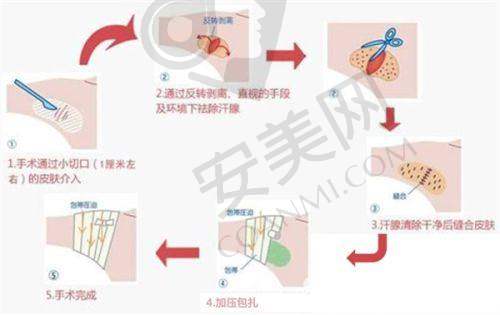 深圳艺星和美莱的品牌实力谁更强？