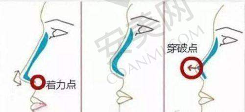 2、湛江韩美王新杰医生擅长项目：