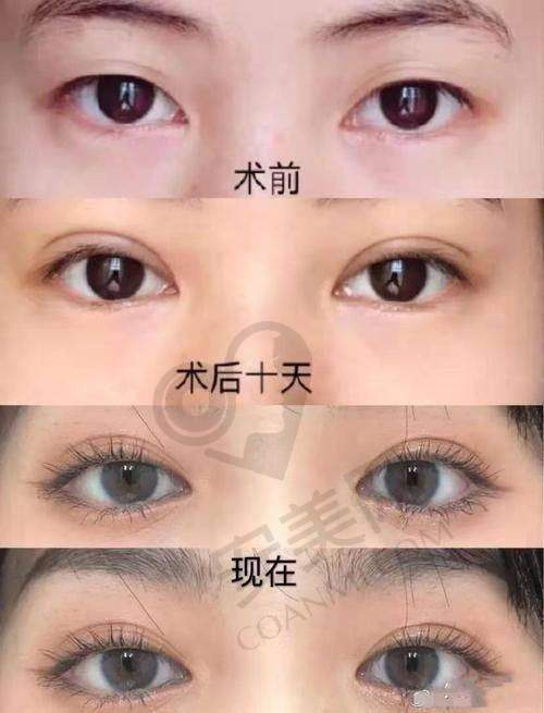 眼部之美，关乎整体魅力