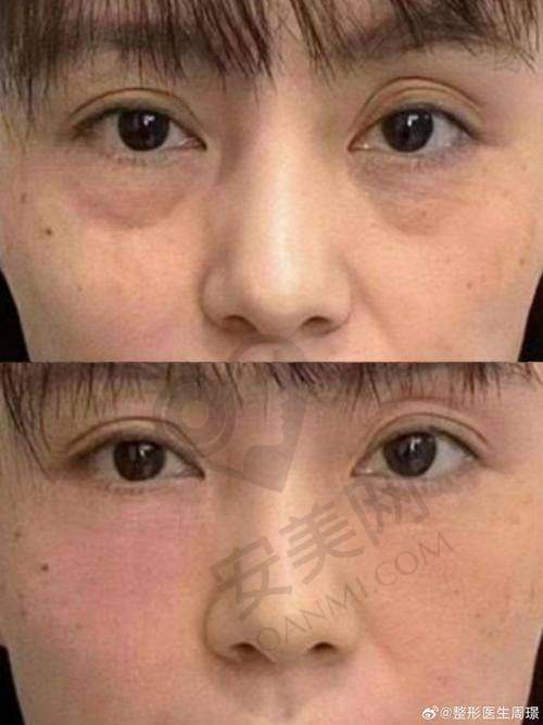 合肥艺星整形美容医院：专研眼部整形的佼佼者