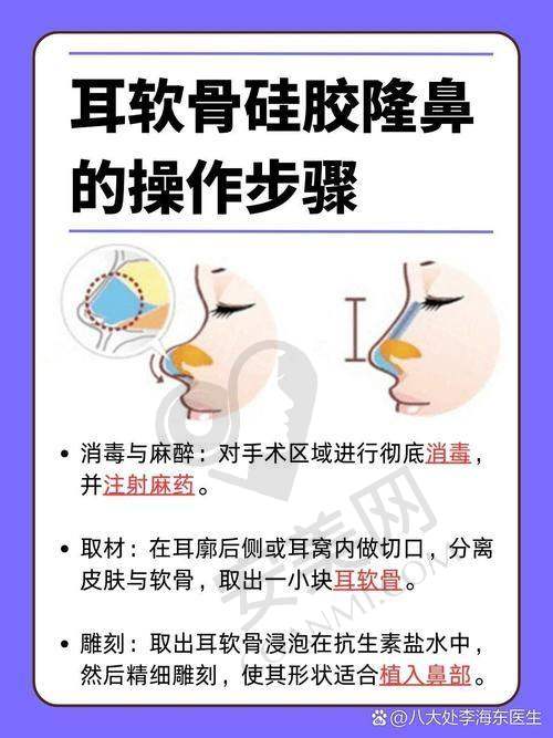 大连星妍8c骨雕鼻的价格构成是怎样的？