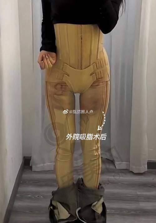 2025上海靠谱抽脂医生都有谁？