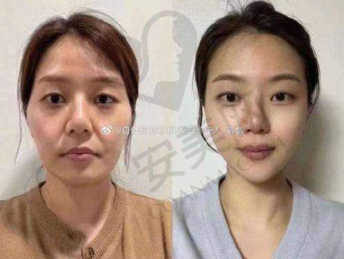 北京禾美嘉与其他脂肪专科医院相比有哪些竞争力？