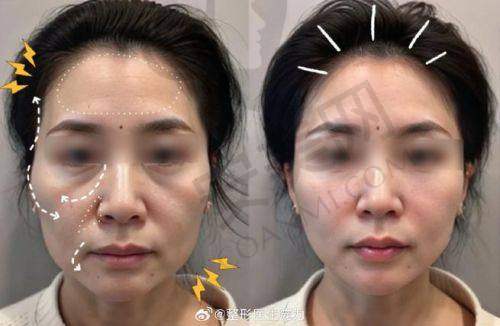 顾客对上海华美注射科医生的评价怎么样？