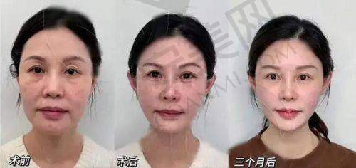 上海华美注射科医生如何提升自身的专精水平？