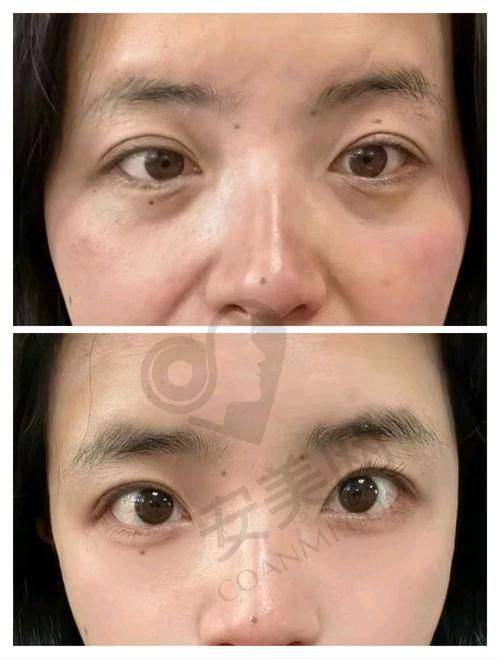 医生专精吗？详细沟通解疑惑