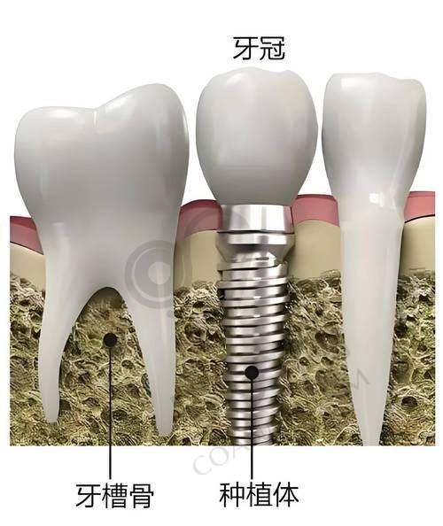 株洲美天笑口腔文树生院长预约挂号指南