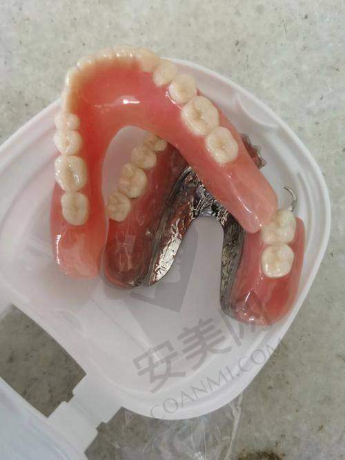 全口活动义齿的制作过程复杂吗？