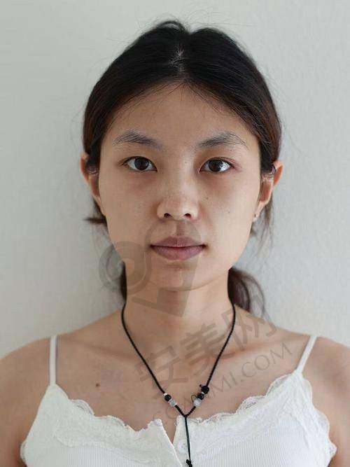 重庆松山医院轮廓磨骨整形的服务质量好不好？