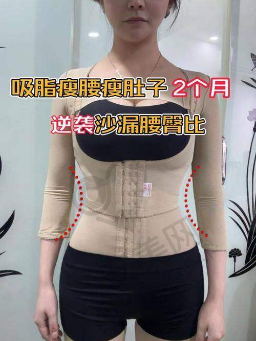 北京润美玉之光腰腹环吸技术的特色在哪里？