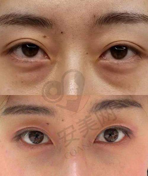治疗成效怎么样？前后对比超惊喜