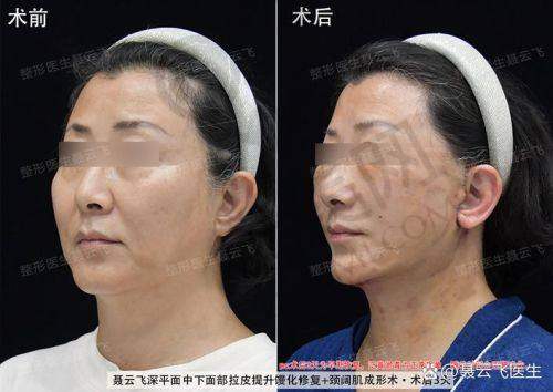 王召东医生：整形界的实力派