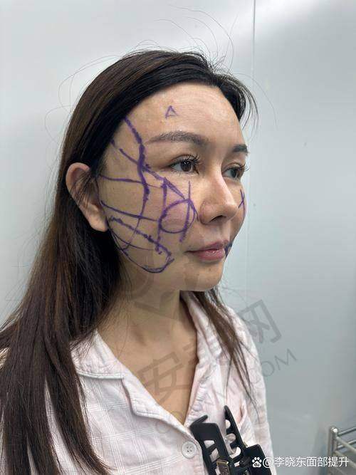 患者眼中的王召东医生
