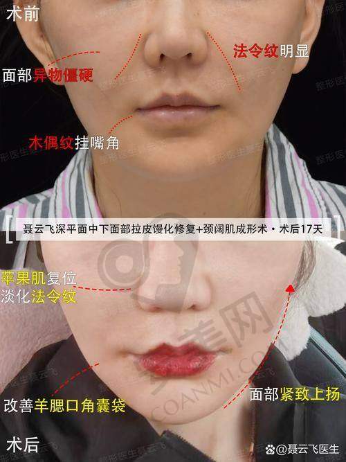 王召东医生：美的守护者