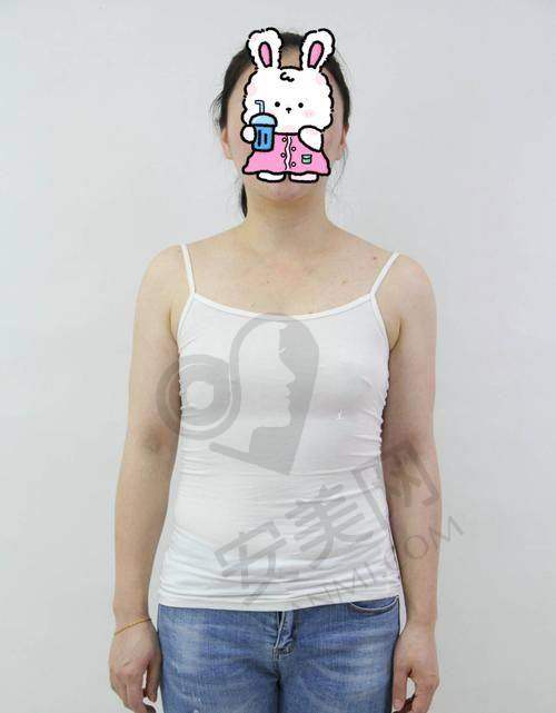 辽宁曙光假体隆胸技术有什么特色？