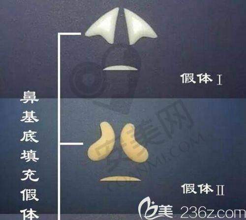 鼻整形假体取出后如何护理？