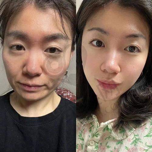 上海华美面部提升的口碑如何？